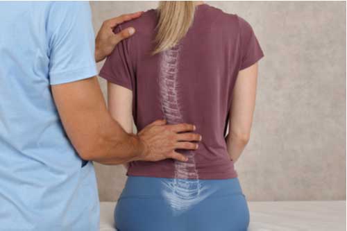 Scoliosis treatment in Coral Springs