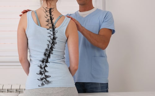 Boca Raton scoliosis treatment, chiropractic posture correction