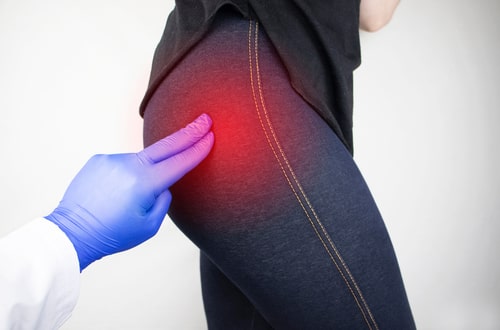 Buttock pain, concept of Boca Raton sciatica treatment